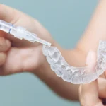 Klinika Invisalign Warszawa